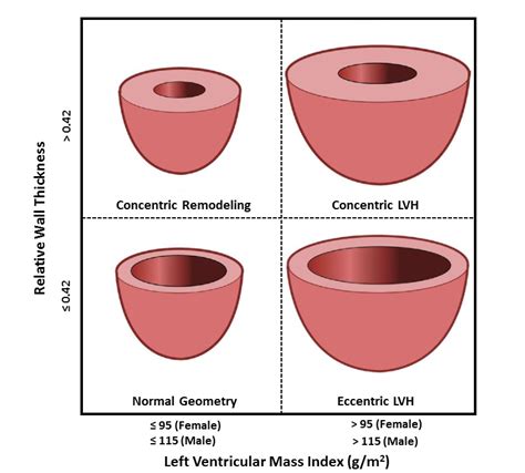 left ventricle thickness measurements|thickness of left ventricle wall.